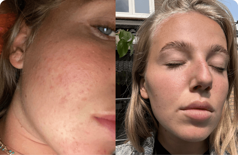 Eline