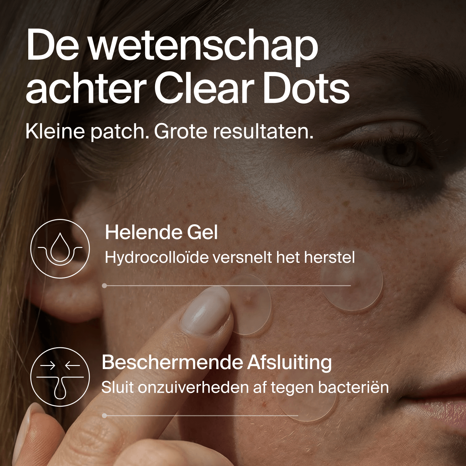 Clear Dots - Acne Patches