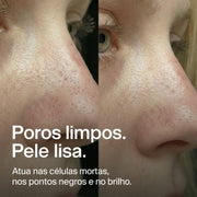 nose-patches gallery 5 (pt)
