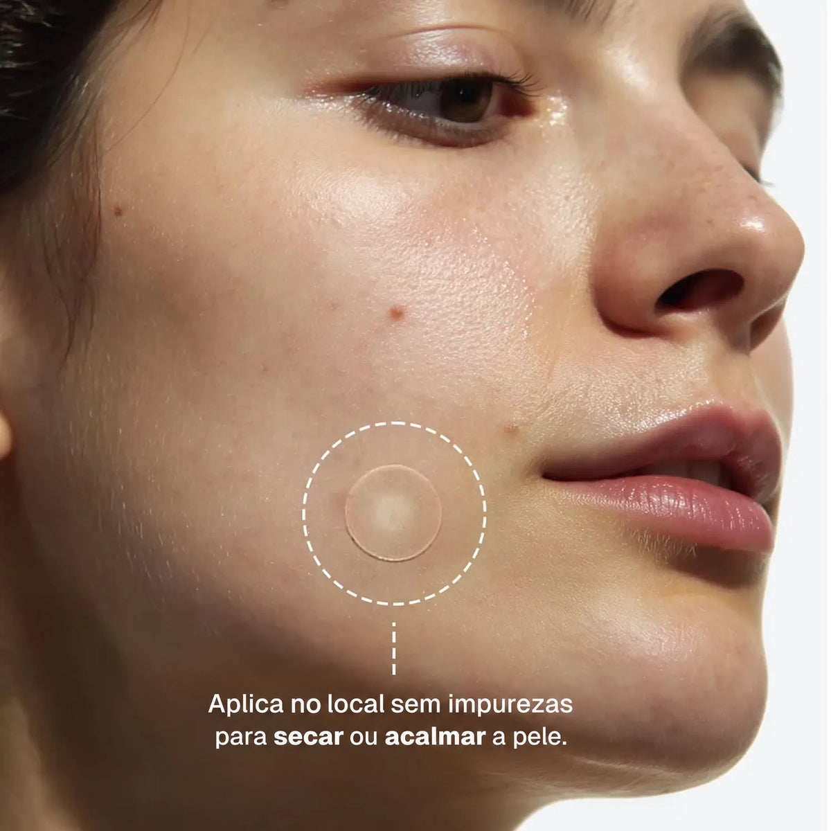 clear-dots-acne-patches gallery 3 (pt)