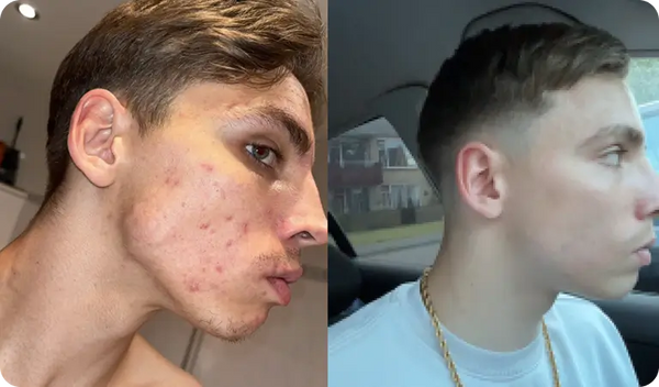 Het enige dat écht werkte