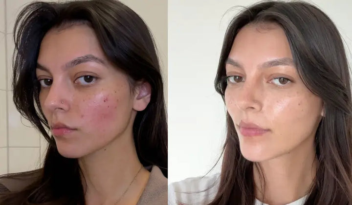 Gabrielle — Após 9 semanas