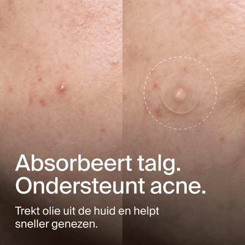 Clear Dots - Acne Patches