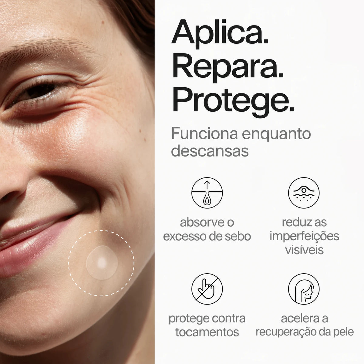 clear-dots-acne-patches gallery 6 (pt)