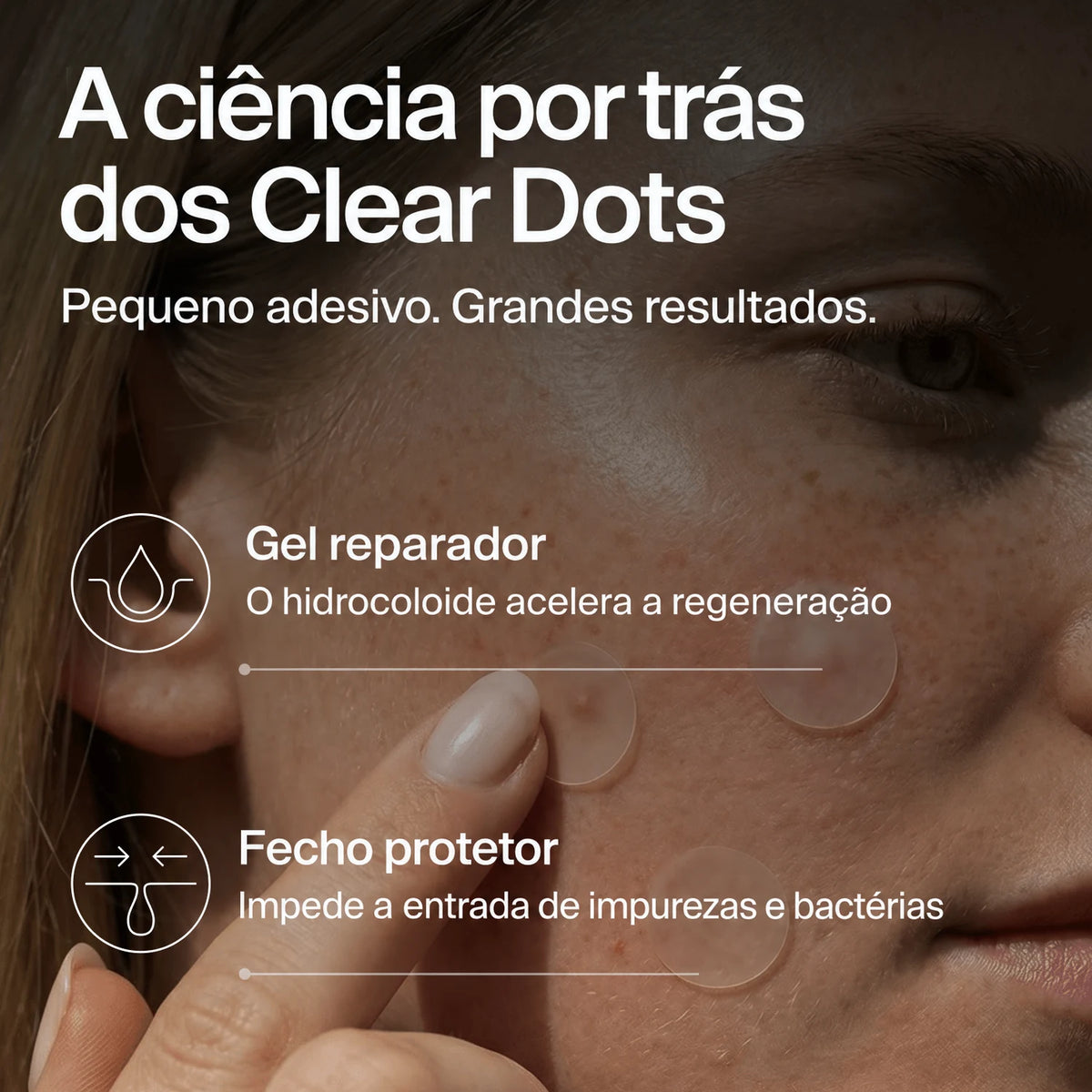 clear-dots-acne-patches gallery 5 (pt)
