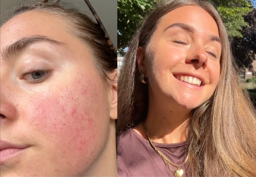 Before / After