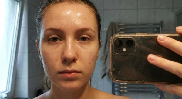 Oily / shiny skin